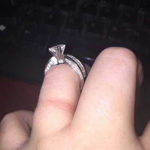 Tại sao đeo nhẫn vàng bị ngứa?