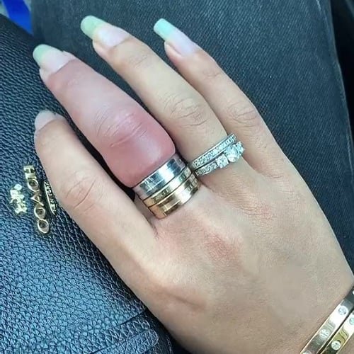 cach thao nhan khi tay bi sung 1 1