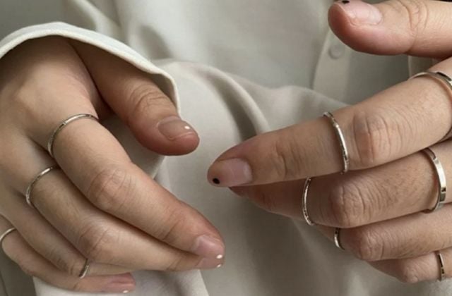 Nhược điểm của vàng 710